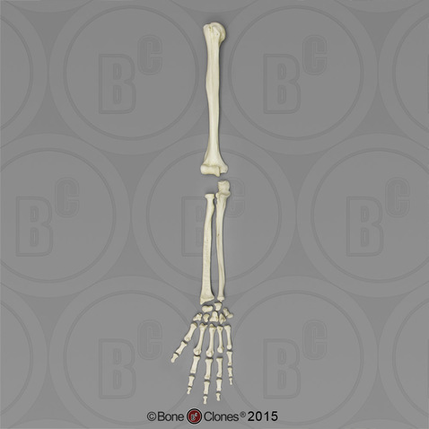 Human Female European Arm, Disarticulated w/ Disarticulated Hand (no Scapula)