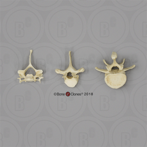 Male Chimpanzee Vertebrae, set of 3 - Cervical, Thoracic, Lumbar
