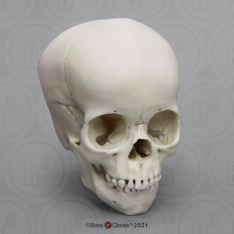 4-year-old Human Child Skull