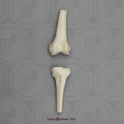 Human Knee Joint, Disarticulated