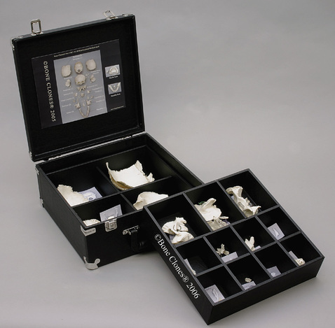 The Premium Custom Case for Human Disarticulated Skulls