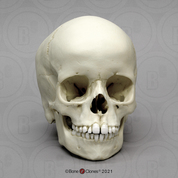 6-year-old Human Child Skull