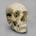 Human Female Skull with Multiple Gunshot Wounds