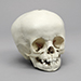 16-month-old Human Child Skull