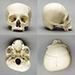Human Adult Cradle-boarded Skull