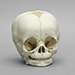4-month-old Human Child Skull