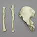 Human Male Surgically Altered Radius, Ulna, Innominate