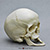 Human Female Achondroplasia Dwarf Skull