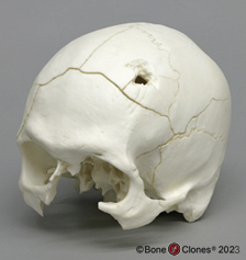 Human Sagittal Cut Half Skull with Brain Hemisphere - Bone Clones