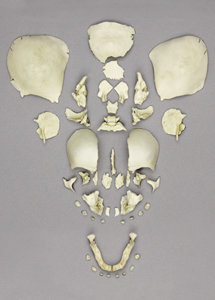 Disarticulated Human Skull-Fetal