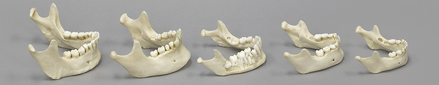 Human Jaw Development