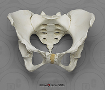 Female Pelvis with Pits of Parturition